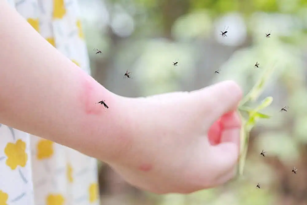 piqure moustique enfant